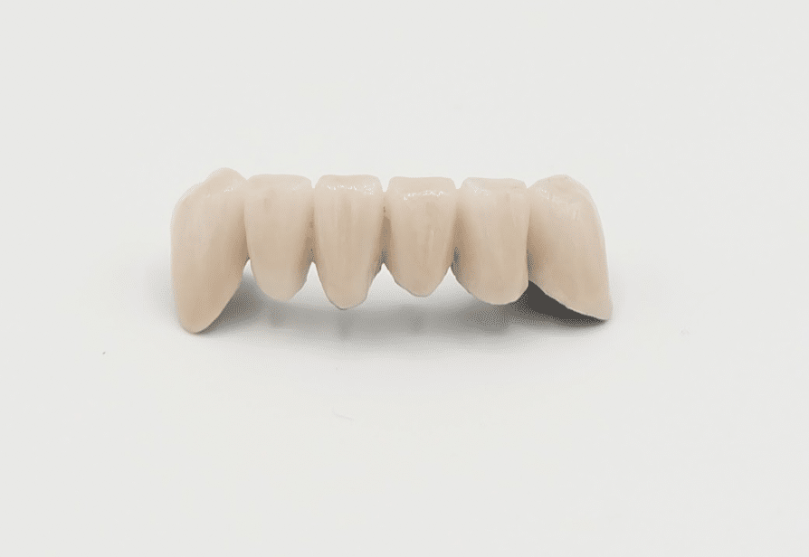 Couronne dentaire céramo métallique CCM - Laboratoire Cristal
