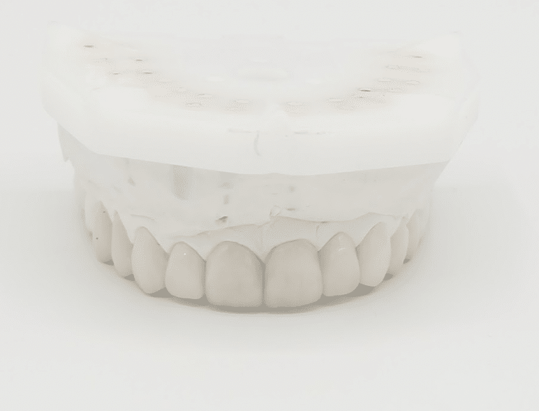 Gouttière de blanchiment dentaire - Laboratoire de prothèse Cristal